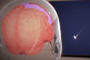 Neuralink, demo chip impiantabile nel cervello per spostare mouse con la mente