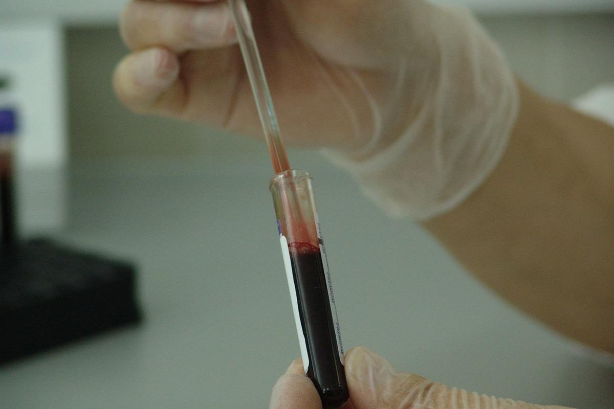 Mortalità per cancro